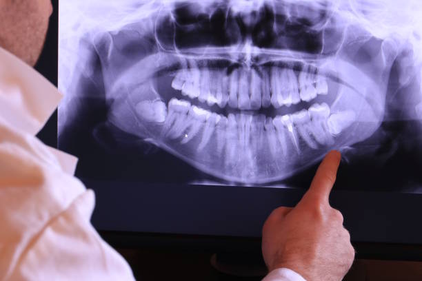 Best Emergency Denture Repair in Helena, OK