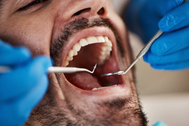 Best 24-Hour Emergency Dental Care in Helena, OK